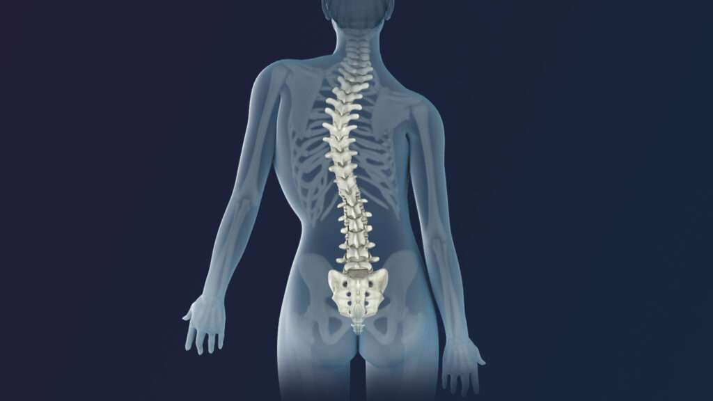 Scoliosis Treatment without surgery