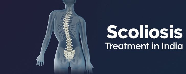 Scoliosis Treatment