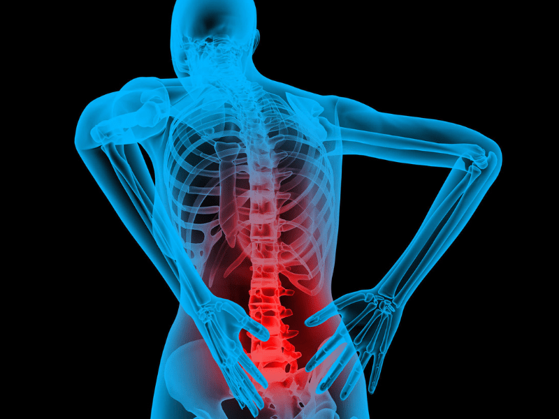 Back Pain Doctor in Lucknow